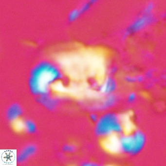 Helicosphaerella recta VR 028703