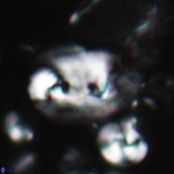 Helicosphaerella recta VR 028704