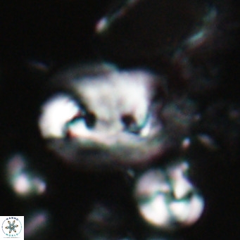 Helicosphaerella recta VR 028704