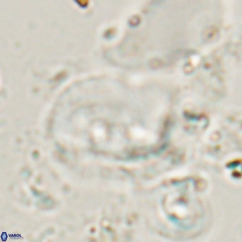 Helicosphaerella recta VR 028705