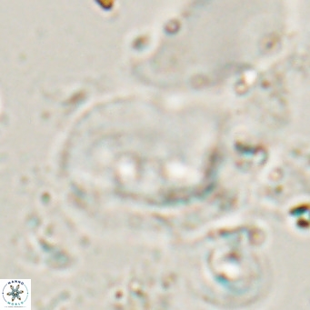 Helicosphaerella recta VR 028705