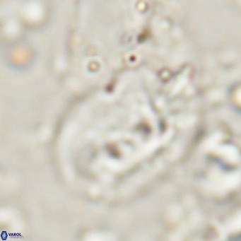 Helicosphaerella recta VR 028706