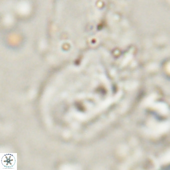 Helicosphaerella recta VR 028706