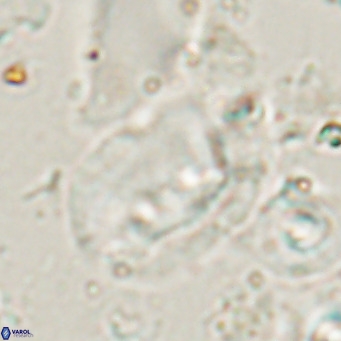 Helicosphaerella recta VR 028707