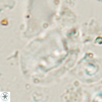 Helicosphaerella recta VR 028707