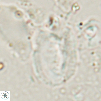 Helicosphaerella recta VR 028708