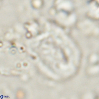Helicosphaerella recta VR 028709