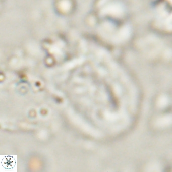 Helicosphaerella recta VR 028709