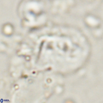 Helicosphaerella recta VR 028710