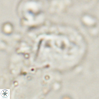 Helicosphaerella recta VR 028710