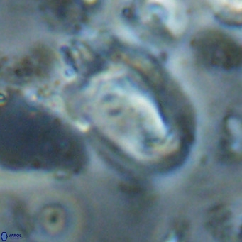 Helicosphaerella recta VR 028712