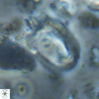 Helicosphaerella recta VR 028712