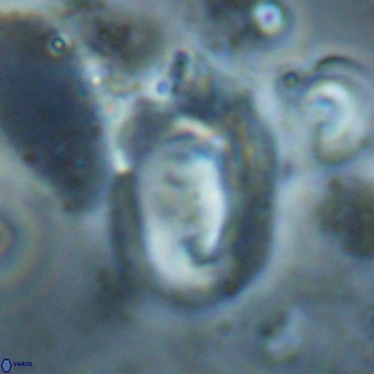 Helicosphaerella recta VR 028715