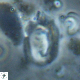 Helicosphaerella recta VR 028715