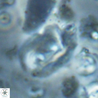 Helicosphaerella recta VR 028716
