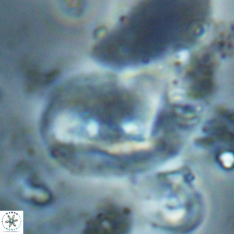 Helicosphaerella recta VR 028717
