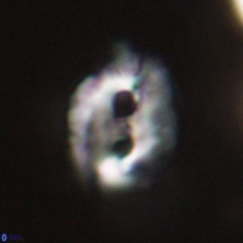 Helicosphaerella recta VR 32734