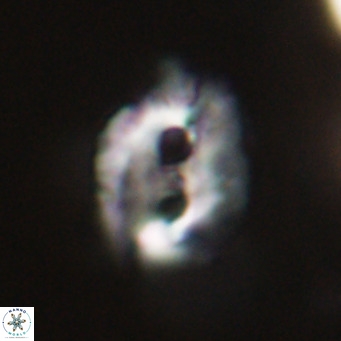 Helicosphaerella recta VR 32734