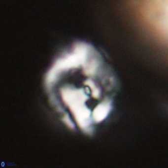 Helicosphaerella recta VR 32735
