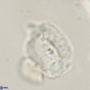 Helicosphaerella recta VR 32737
