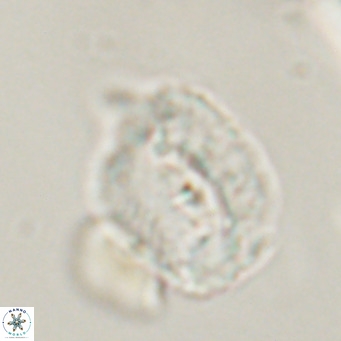 Helicosphaerella recta VR 32737