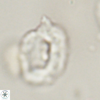 Helicosphaerella recta VR 32738