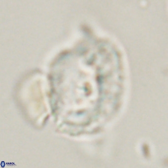Helicosphaerella recta VR 32739