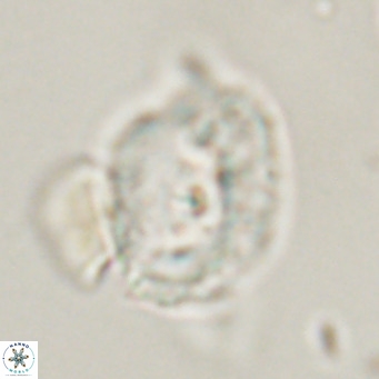 Helicosphaerella recta VR 32739