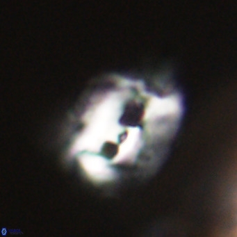 Helicosphaerella recta VR 32731