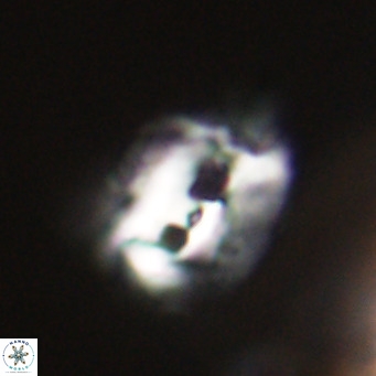 Helicosphaerella recta VR 32731