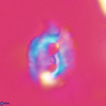 Helicosphaerella recta VR 32733