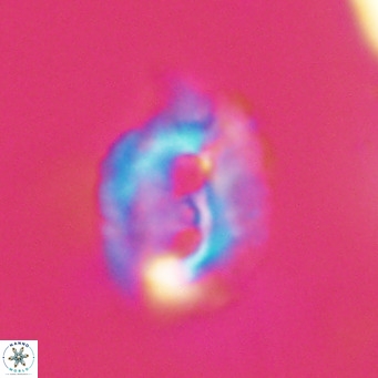 Helicosphaerella recta VR 32733