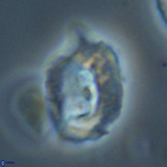 Helicosphaerella recta VR 32744