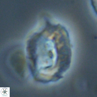 Helicosphaerella recta VR 32744