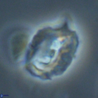 Helicosphaerella recta VR 32745
