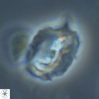 Helicosphaerella recta VR 32745