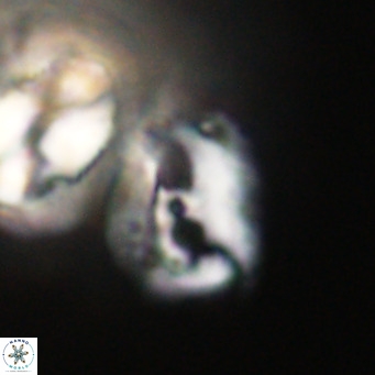 Helicosphaerella recta VR 32747