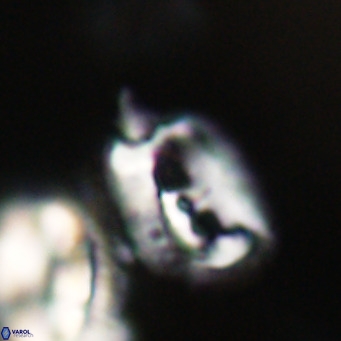 Helicosphaerella recta VR 32748