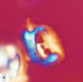 Helicosphaerella recta VR 32749