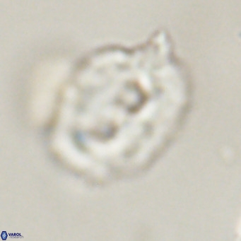Helicosphaerella recta VR 32740