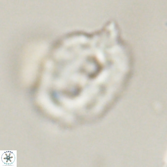 Helicosphaerella recta VR 32740