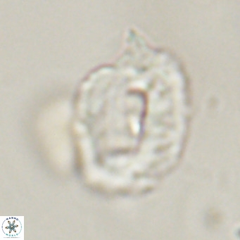 Helicosphaerella recta VR 32741