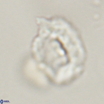 Helicosphaerella recta VR 32742