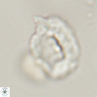 Helicosphaerella recta VR 32742