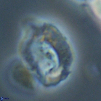 Helicosphaerella recta VR 32743