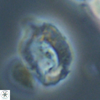 Helicosphaerella recta VR 32743