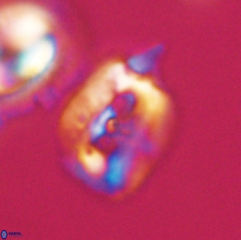 Helicosphaerella recta VR 32754