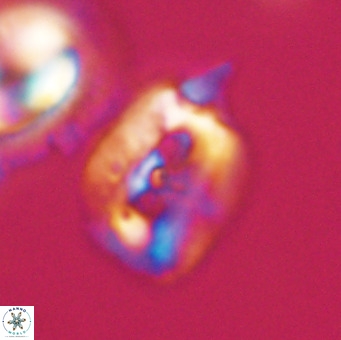 Helicosphaerella recta VR 32754