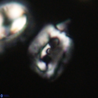 Helicosphaerella recta VR 32755
