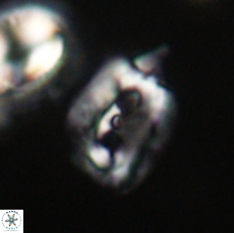 Helicosphaerella recta VR 32755